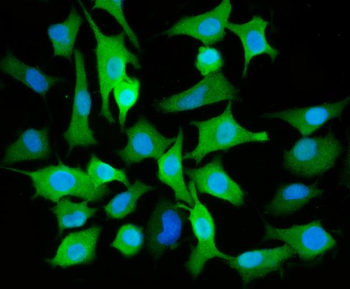 ALDH3A1 Rabbit Polyclonal Antibody