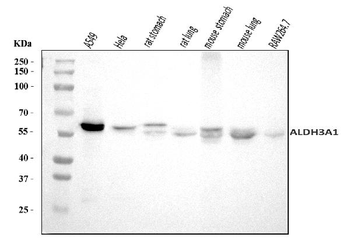 ALDH3A1 Rabbit Polyclonal Antibody