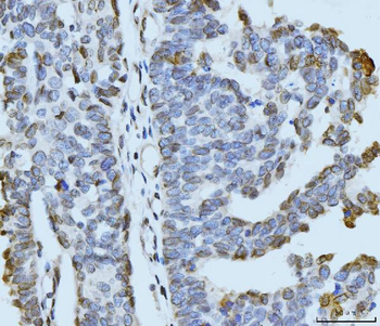 ARL6IP6 Antibody