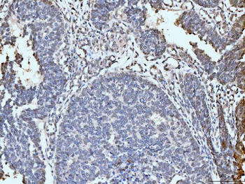 ARL6IP6 Antibody