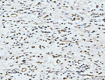 ARL6IP6 Antibody
