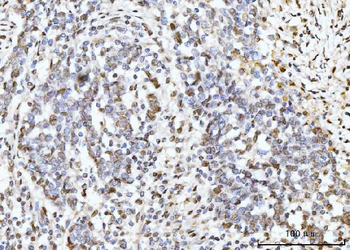 ARL6IP6 Antibody