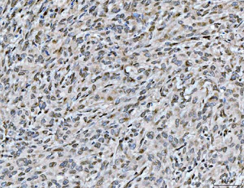 ARL6IP6 Antibody
