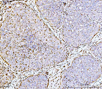 ARL6IP6 Antibody