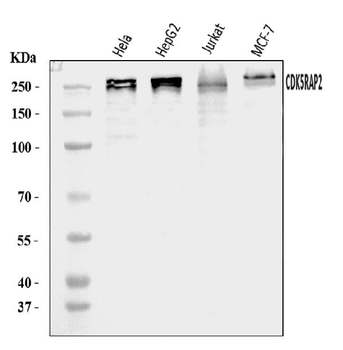 CDK5RAP2 Rabbit Polyclonal Antibody