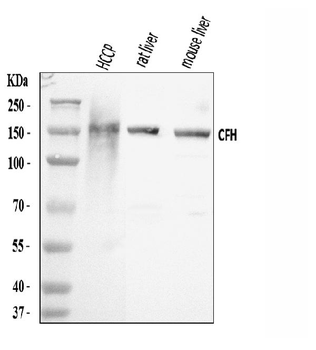 Factor H/CFH Rabbit Polyclonal Antibody