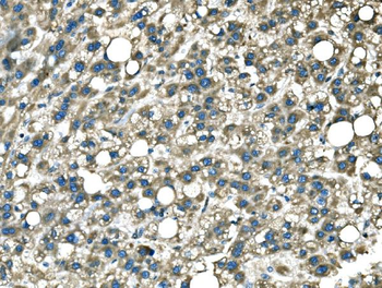 DROSHA Rabbit Polyclonal Antibody