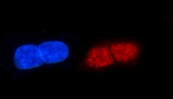 ERCC1 Rabbit Polyclonal Antibody