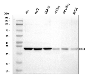ERCC1 Rabbit Polyclonal Antibody