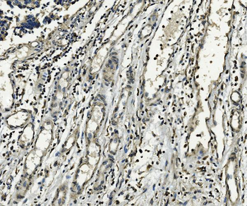 XPD/ERCC2 Rabbit Polyclonal Antibody