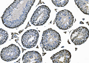 XPD/ERCC2 Rabbit Polyclonal Antibody