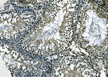 XPD/ERCC2 Rabbit Polyclonal Antibody