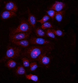 FBP1 Rabbit Polyclonal Antibody