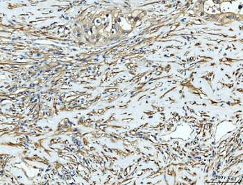 FHL2 Rabbit Polyclonal Antibody