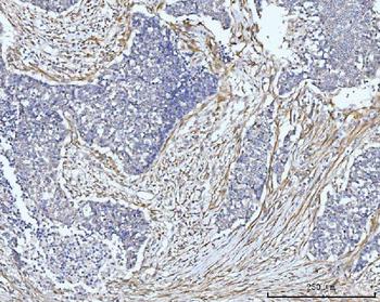 FHL2 Rabbit Polyclonal Antibody