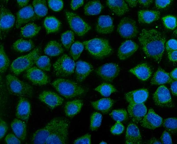KEAP1 Rabbit Polyclonal Antibody