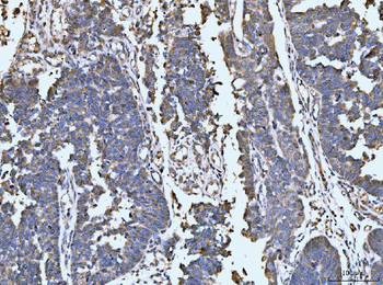 LARP1 Antibody