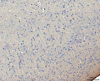 MAP2 Rabbit Polyclonal Antibody