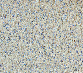 MAP2 Rabbit Polyclonal Antibody
