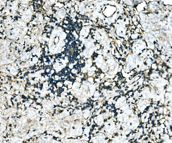 MEF2B Rabbit Polyclonal Antibody