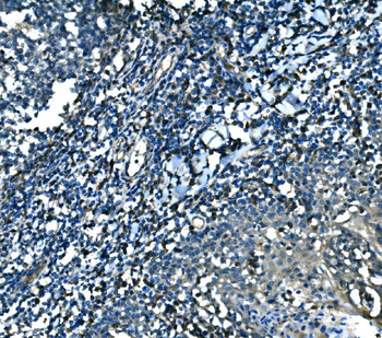 MEF2B Rabbit Polyclonal Antibody