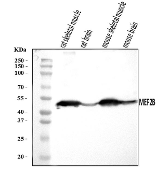 MEF2B Rabbit Polyclonal Antibody