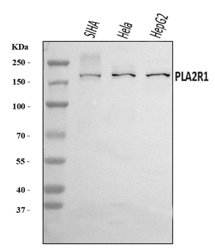 PLA2R/PLA2R1 Rabbit Polyclonal Antibody