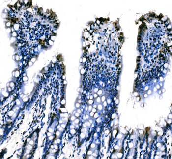 splicing factor 1 Antibody (monoclonal, 7D9E3)