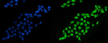 splicing factor 1 Antibody (monoclonal, 7D9E3)