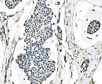 splicing factor 1 Antibody (monoclonal, 7D9E3)