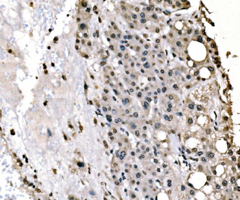 splicing factor 1 Antibody (monoclonal, 7D9E3)