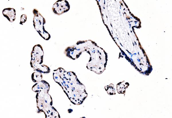 splicing factor 1 Antibody (monoclonal, 7D9E3)