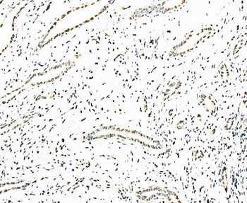 splicing factor 1 Antibody (monoclonal, 7D9E3)