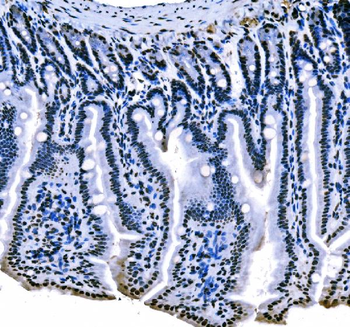 splicing factor 1 Antibody (monoclonal, 2F5D10)