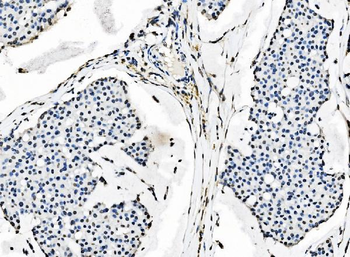 splicing factor 1 Antibody (monoclonal, 2F5D10)