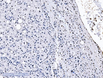 splicing factor 1 Antibody (monoclonal, 2F5D10)