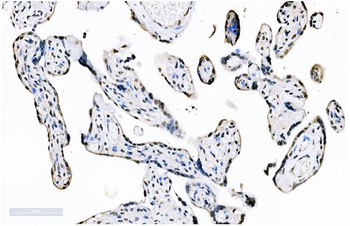 splicing factor 1 Antibody (monoclonal, 2F5D10)
