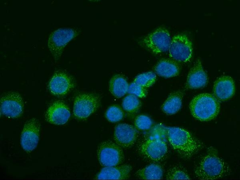 Glutaminase/GLS Antibody (monoclonal, 3G13)