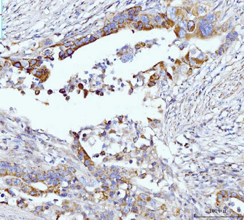 Glutaminase/GLS Antibody (monoclonal, 3G13)