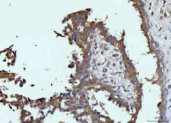 Glutaminase/GLS Antibody (monoclonal, 3G13)