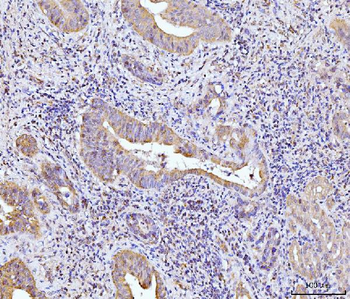 Glutaminase/GLS Antibody (monoclonal, 3G13)