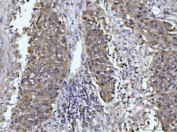 Glutaminase/GLS Antibody (monoclonal, 3G13)