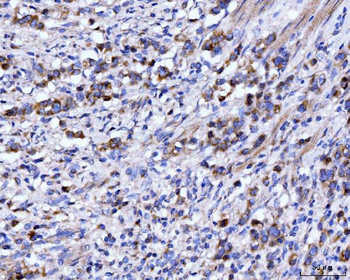 DHODH Mouse Monoclonal Antibody