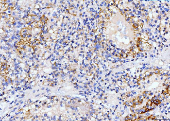 DHODH Mouse Monoclonal Antibody