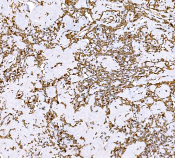 SND1 Mouse Monoclonal Antibody