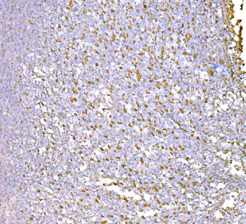 SND1 Mouse Monoclonal Antibody
