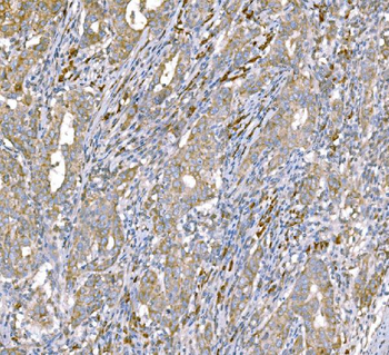 SND1 Antibody (monoclonal, 6G3B4)