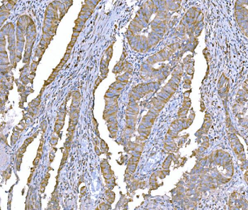 SND1 Antibody (monoclonal, 6G3B4)