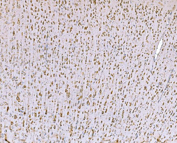 SND1 Antibody (monoclonal, 6G3B4)