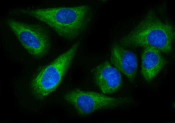 EPRS1/PARS Mouse Monoclonal Antibody
